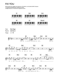 Fix You von Coldplay (Download) 